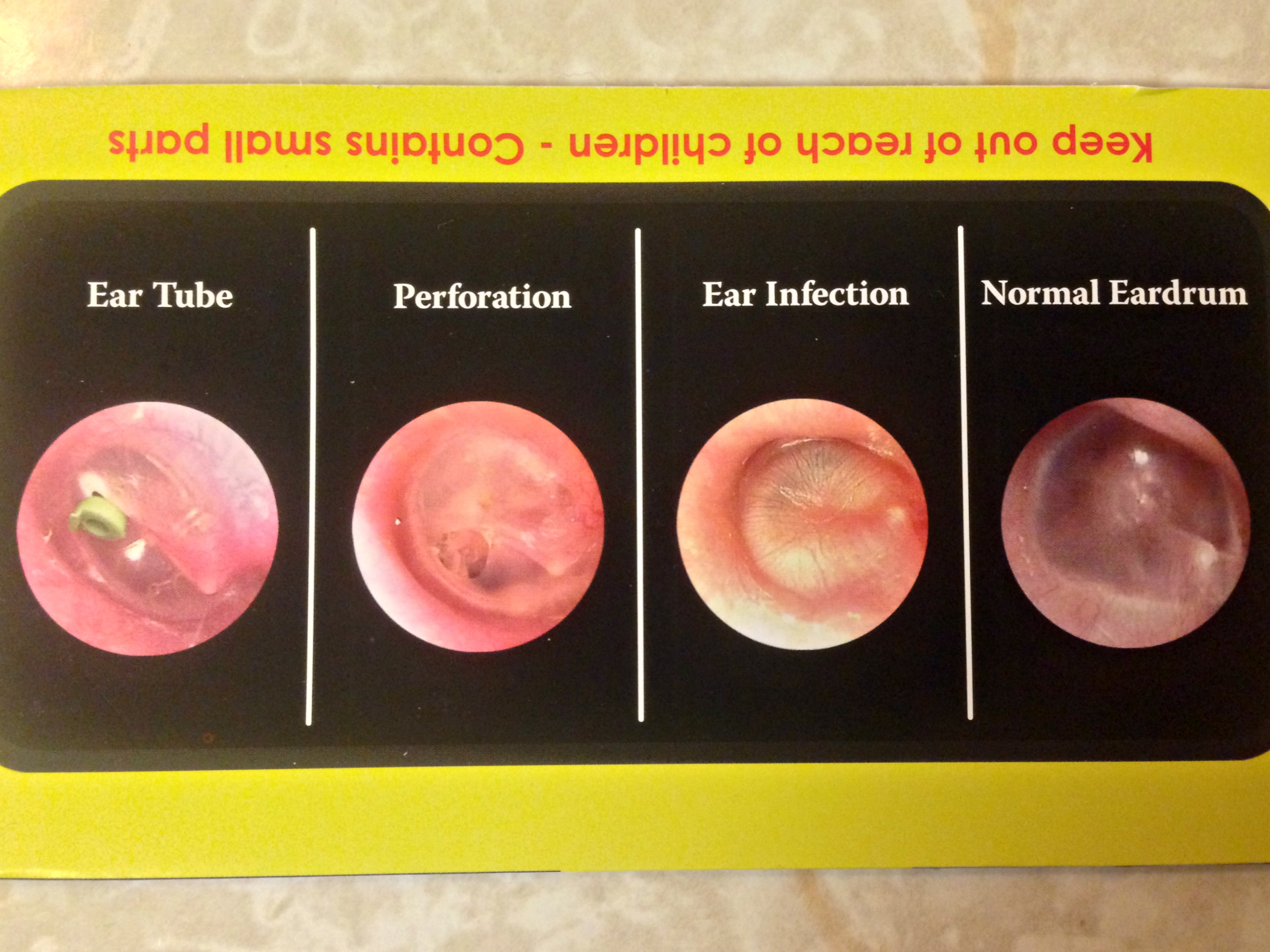 Ear Canal Infection Diagram at Alvarez blog